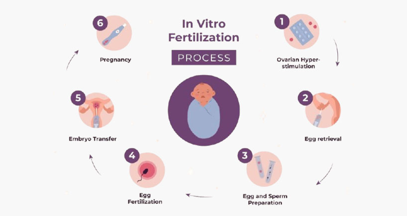 A Step-by-Step Guide to the IVF Process